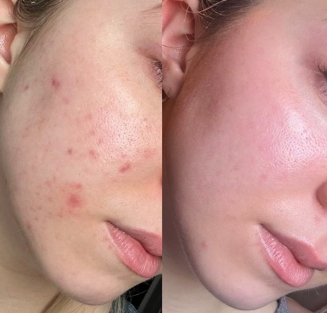 Arkin Natural Skin Glow Serum™
