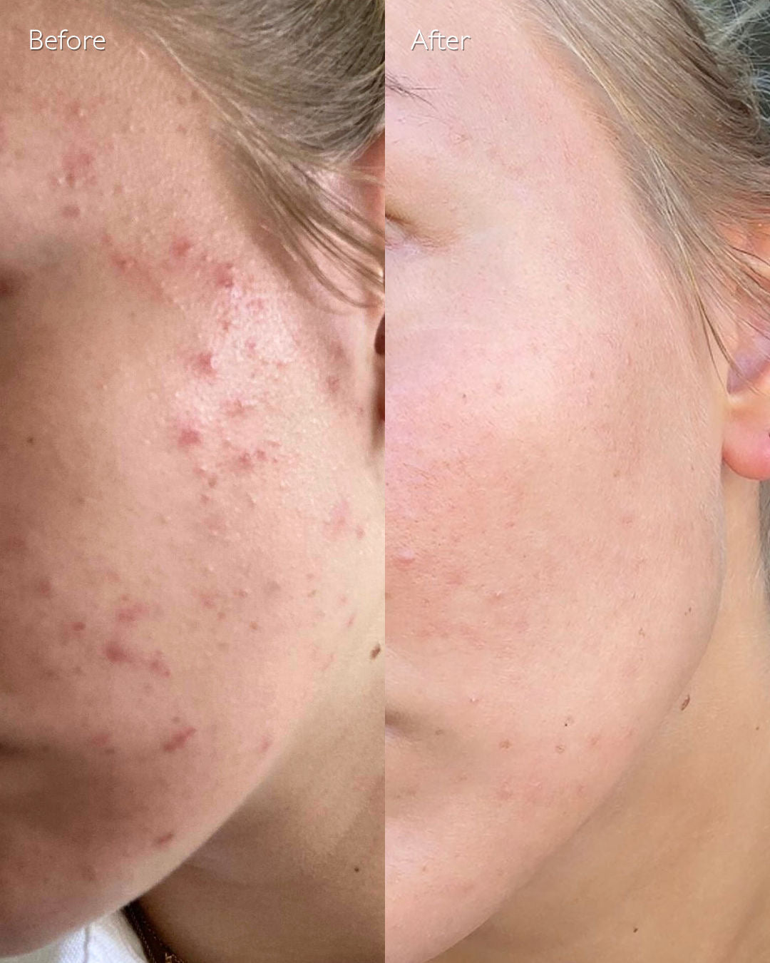 Arkin Natural Skin Glow Serum™