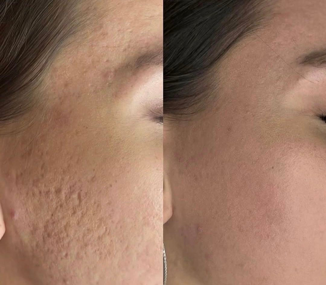 Arkin Natural Skin Glow Serum™