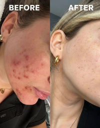 Arkin Natural Skin Glow Serum™