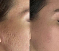 Arkin Natural Skin Glow Serum™